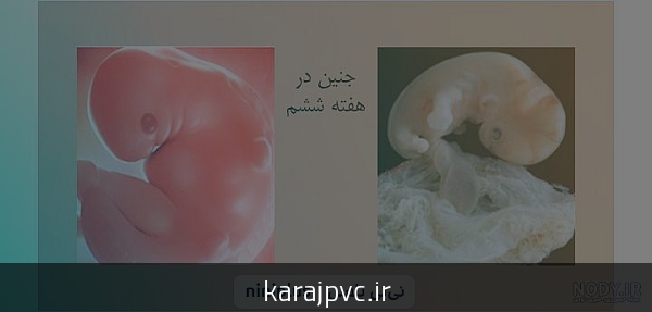 جنین هفت ماهه